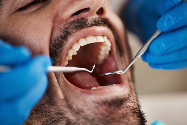 Best Urgent Dental Care for Toothache in Mineral Springs, NC