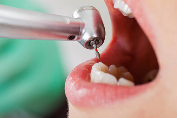 Best Broken or Cracked Tooth Emergency Dentist in Mineral Springs, NC